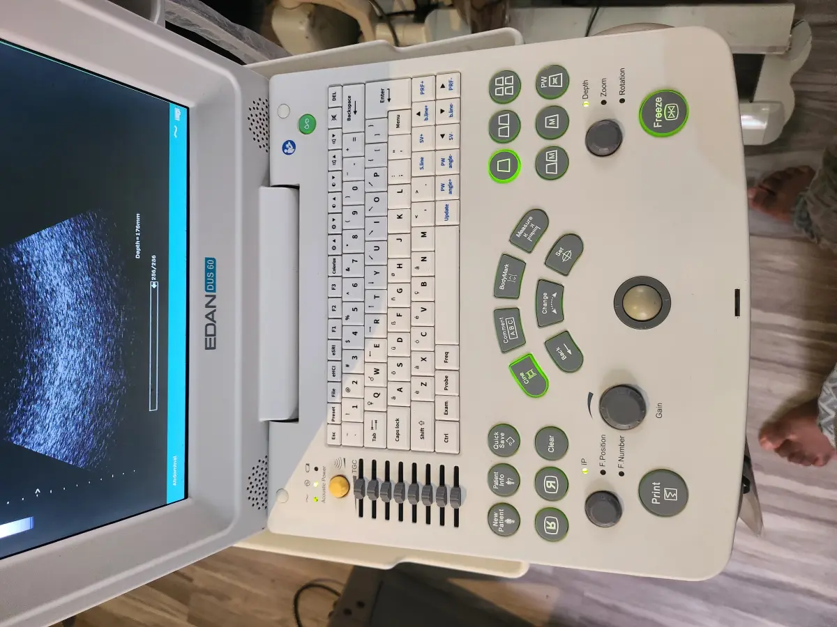 Edan dus 60 table top ultrasound Machine