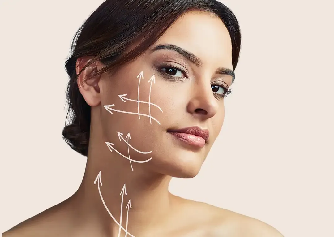 Rostro de mujer con flechas marcando líneas de tensión facial ascendente