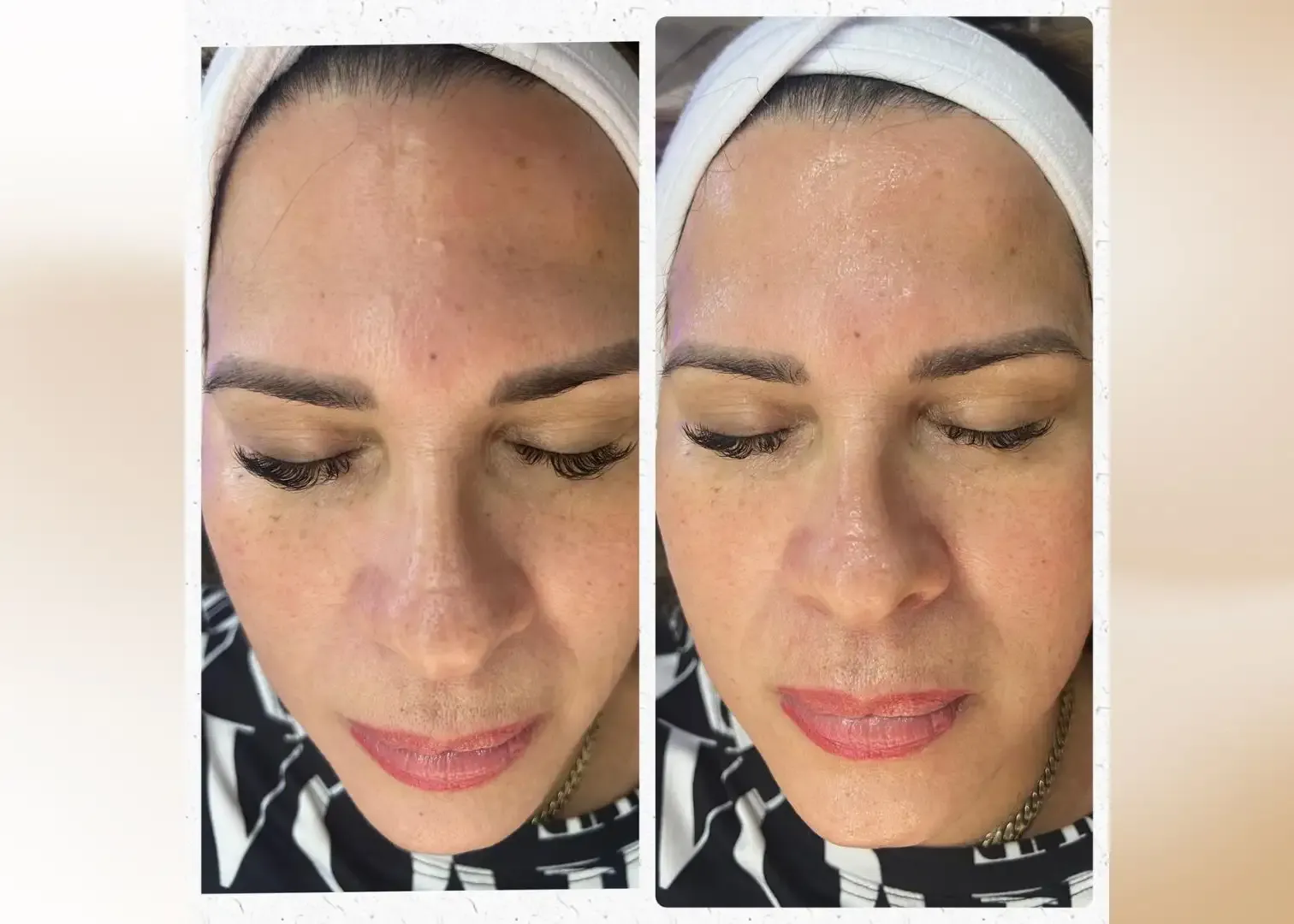 Aquafirme XS - Resultados del tratamiento 1