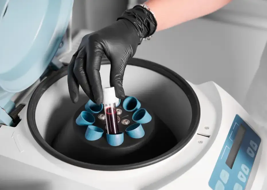 Elaboración de Plasma Gel