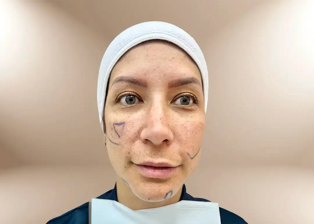 Imagen antes del tratamiento