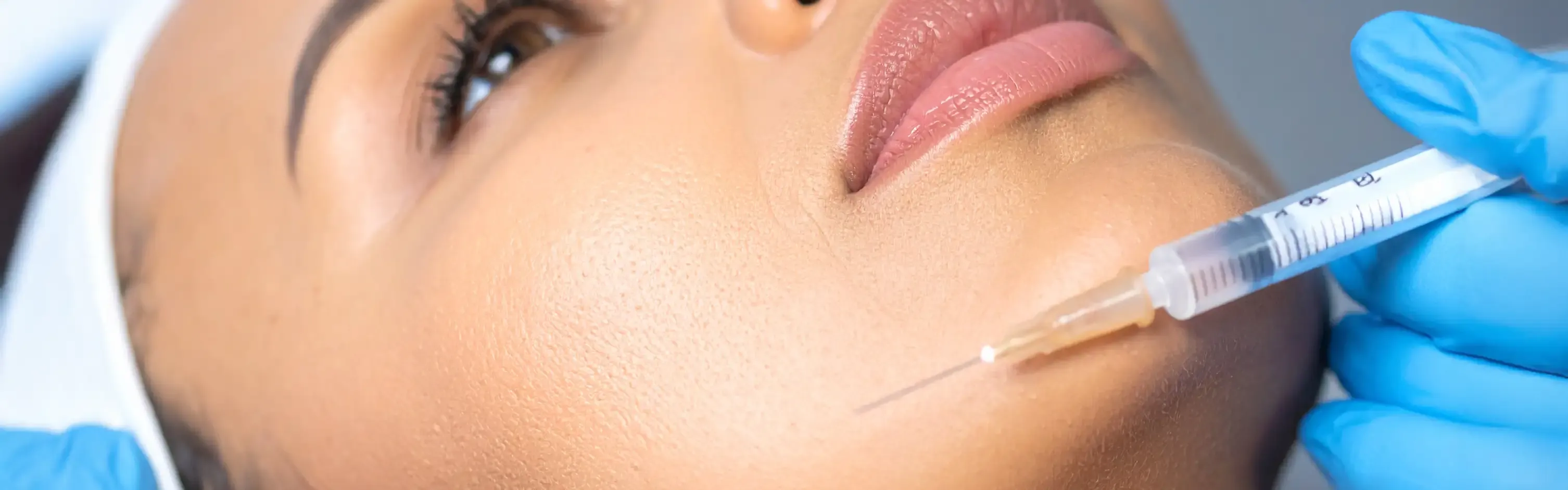 Radiesse - VIP Proage Wellness