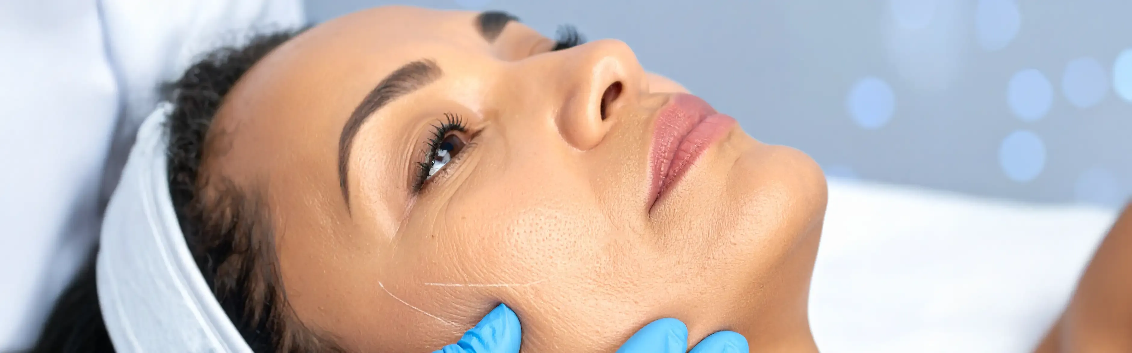 Bellafill - VIP Proage Wellness