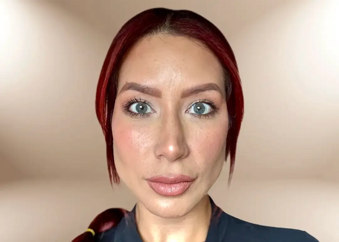 Imagen después del tratamiento