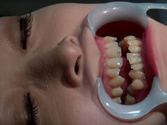 歯フェチ!本物の歯治療映像 小百合