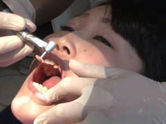 歯フェチ!本物歯治療映像虫歯掘削処置 堀越まき