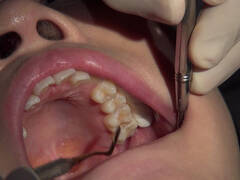 歯フェチ!本物歯科治療映像 井野紅葉