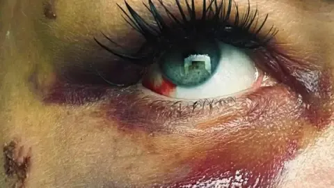 A Woman Rejected an MMA Fighter on a Night Out - So He Punched Me.