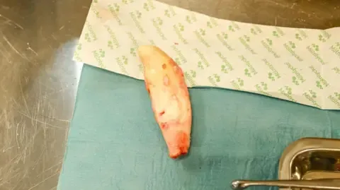 Rescued Ukrainian Lion Undergoes Essential Surgery