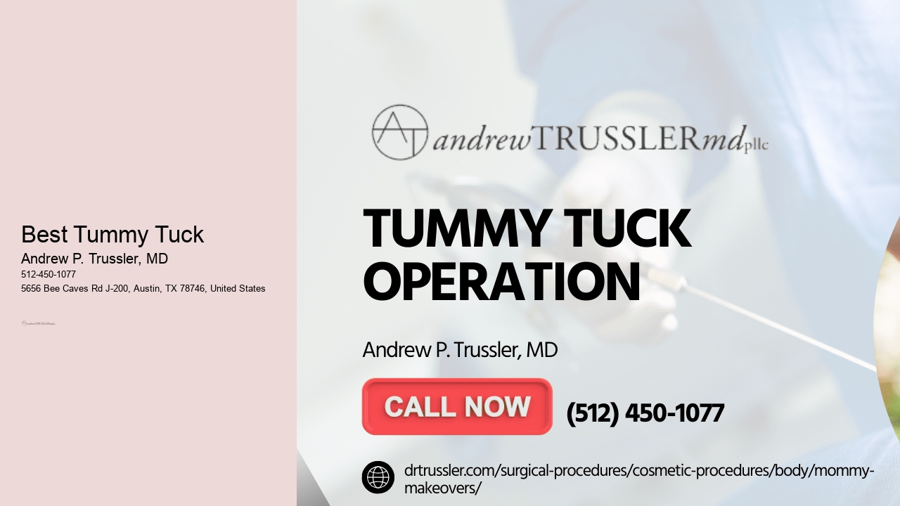 Best Tummy Tuck