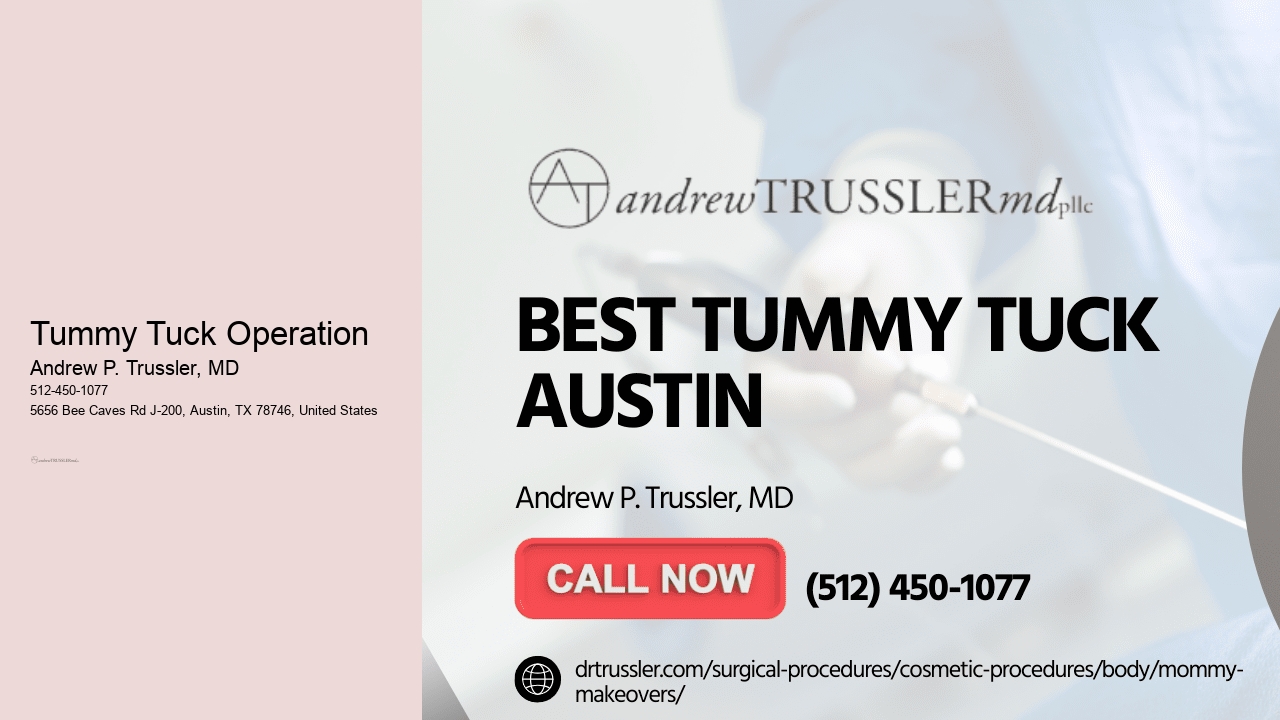 Tummy Tuck Operation