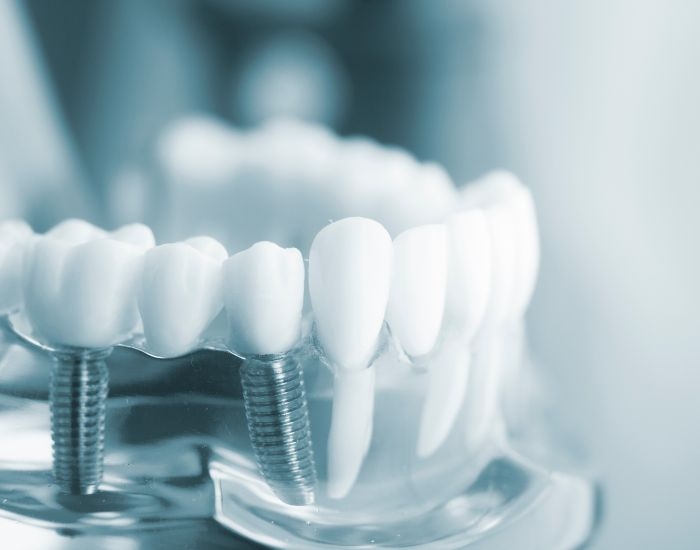 What dental technologies and treatments are available at dentists in Chattanooga?