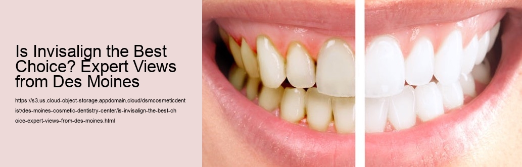 Is Invisalign the Best Choice? Expert Views from Des Moines