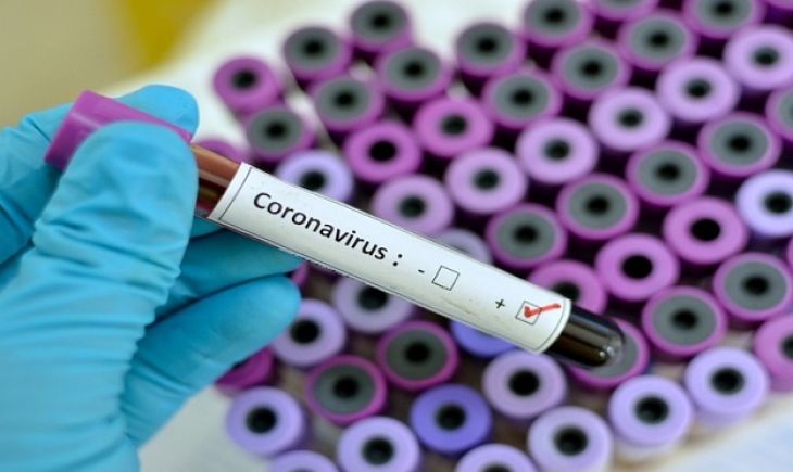 MS toma 100 medidas contra a crise do novo coronavírus
