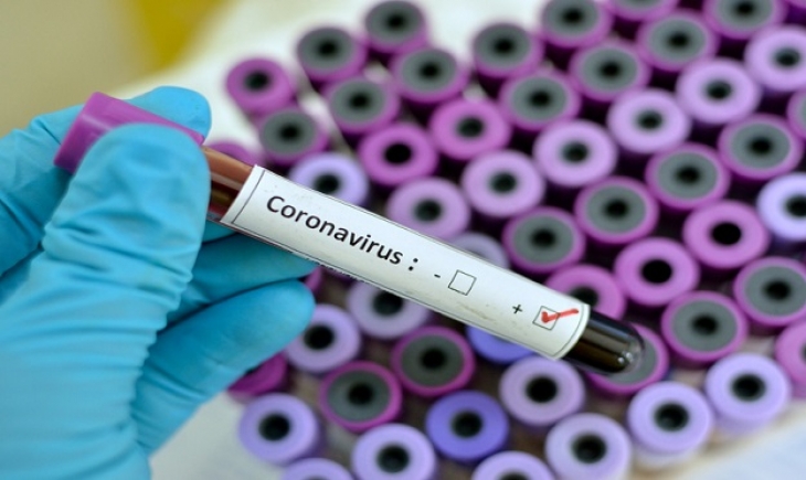 Coronavírus: MS tem 8 novos casos confirmados, alcançando agora 44 pessoas.
