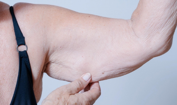 Pouca massa muscular pode indicar risco de morte para idosos