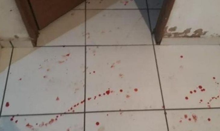 Costa Rica: Mulher invade casa, tenta matar adolescente e acaba esfaqueando três
