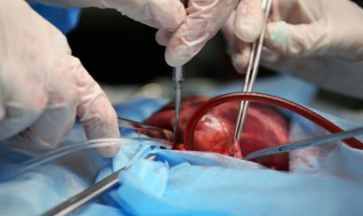 Transplantes realizados no Estado este ano deram nova chance de vida para 100 sul-mato-grossenses