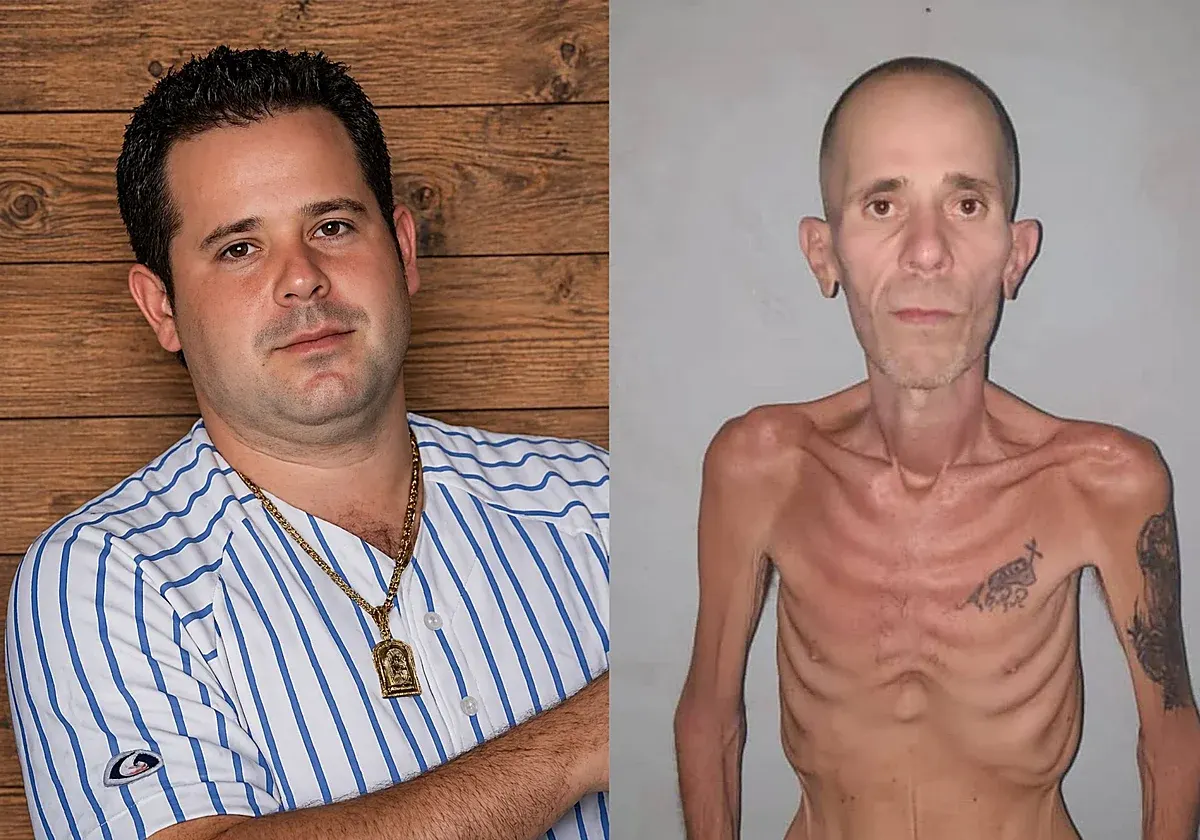 De 81 kg a 37 kg: o estado de Alexander Díaz após anos preso em Cuba choca o mundo