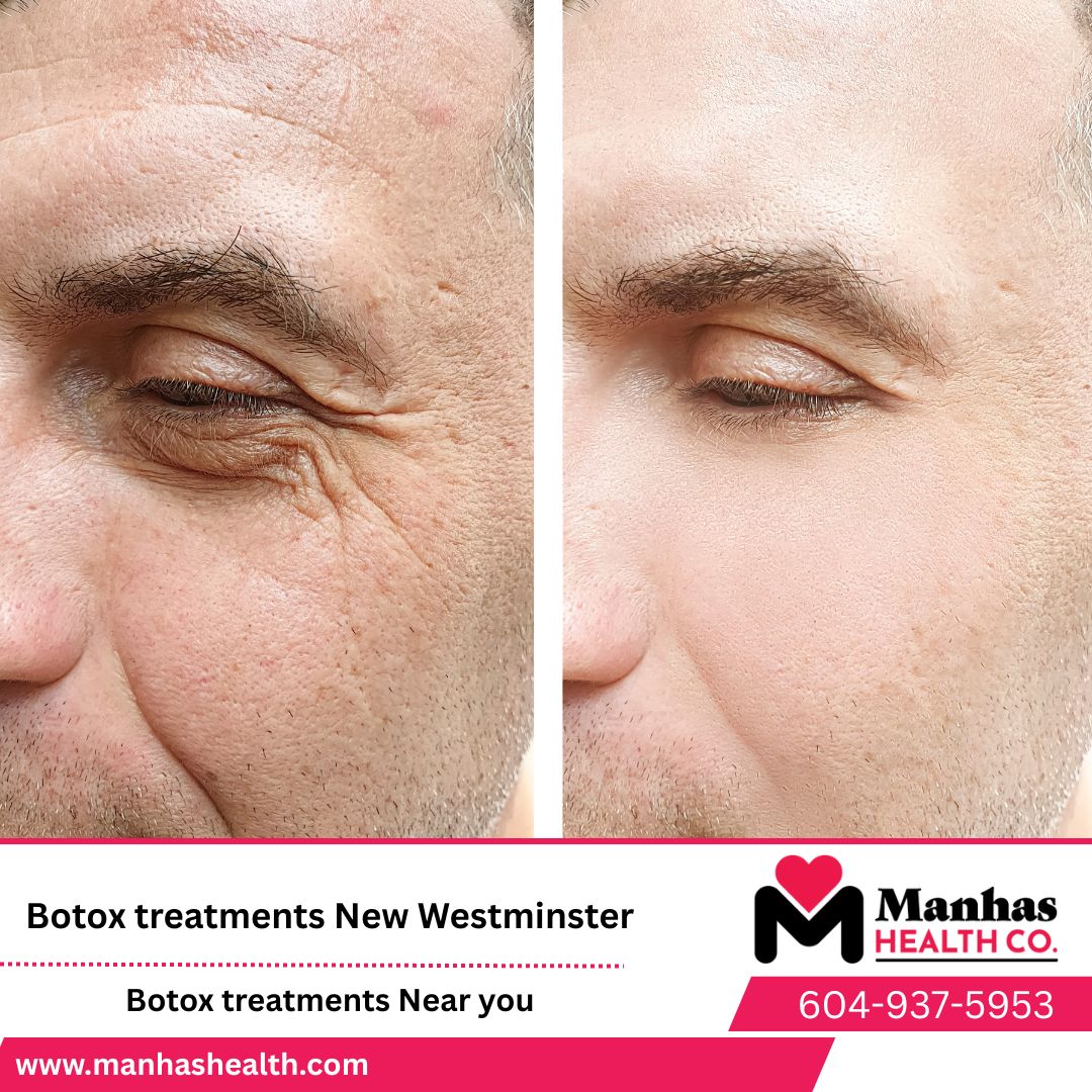 Best Botox and Filler clinic in Burnaby