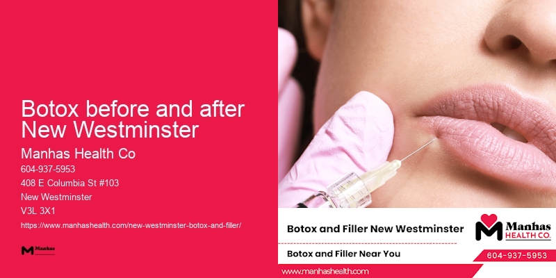 Botox for frown lines Botox before and after New Westminster