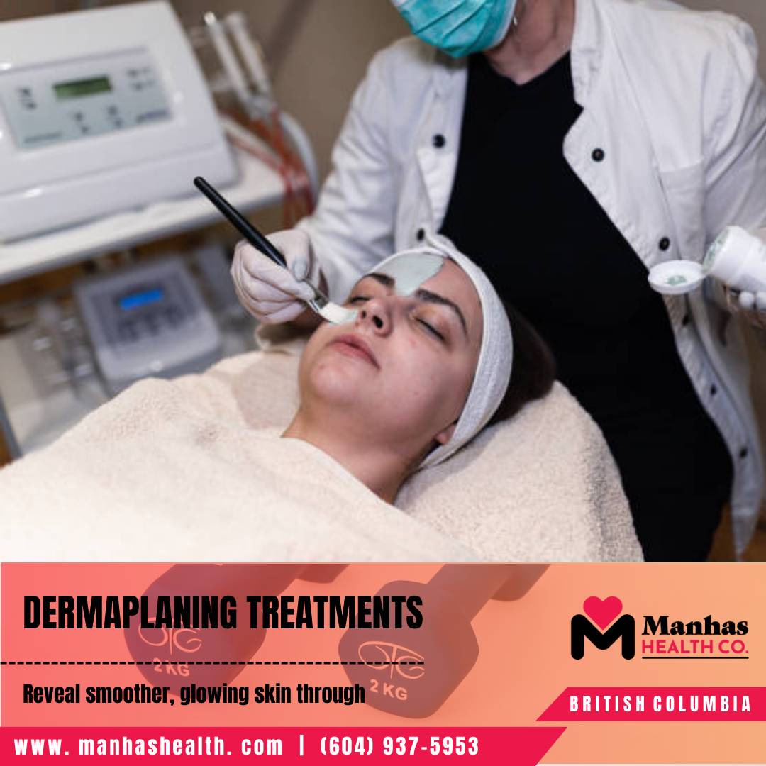 Botox injections for lip lines in New Westminster