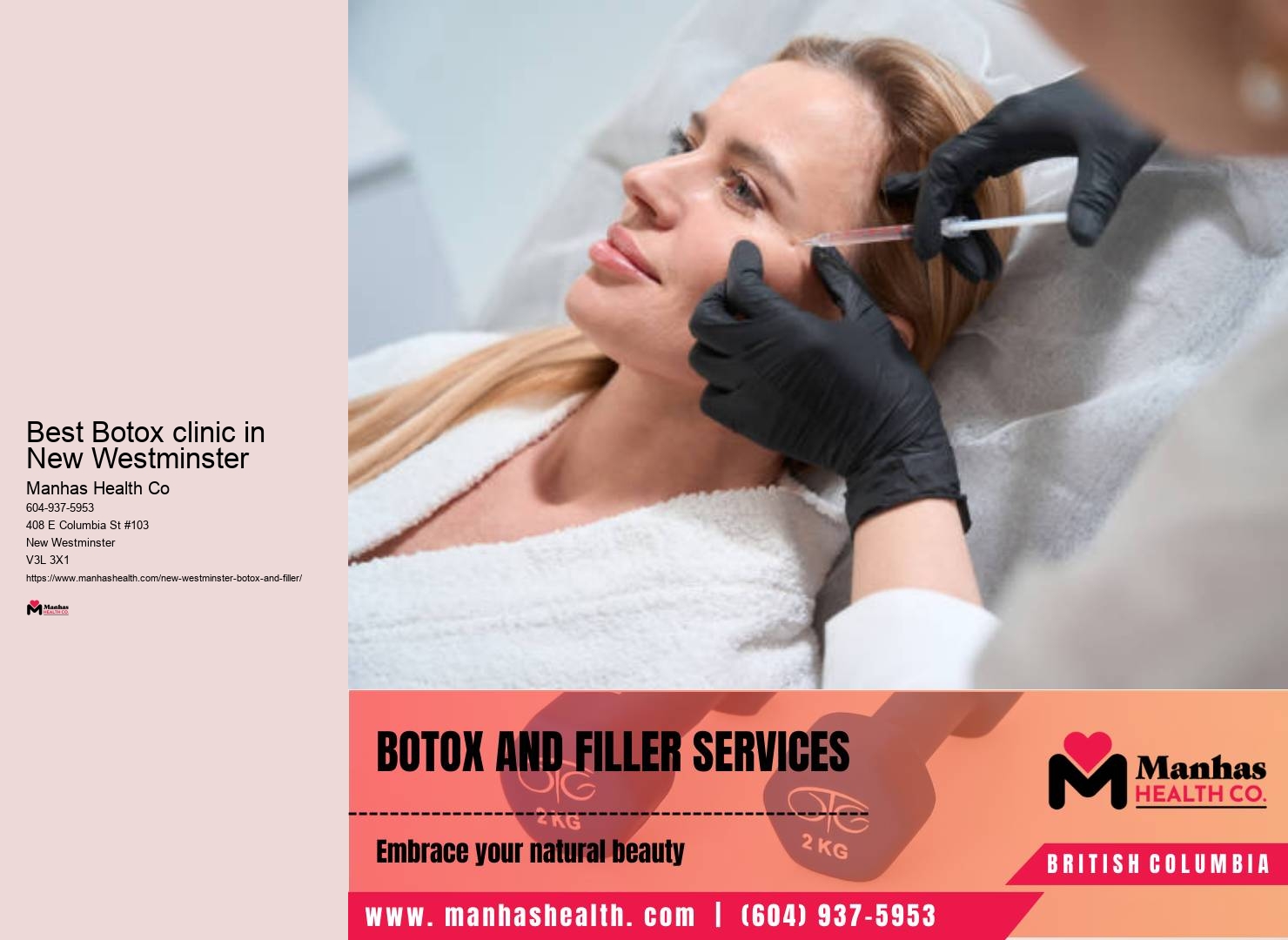 Botox for marionette lines in New Westminster