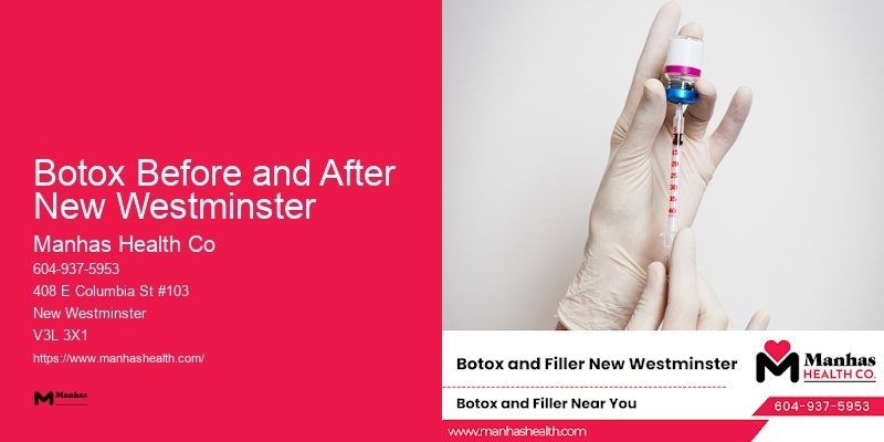 Botox and Facial Rejuvenation Botox Before and After New Westminster