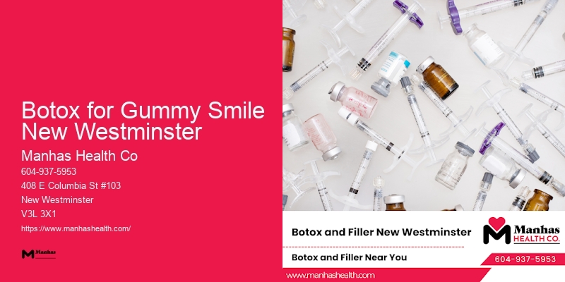 State-of-the-Art Cosmetic Injections Botox for Gummy Smile New Westminster
