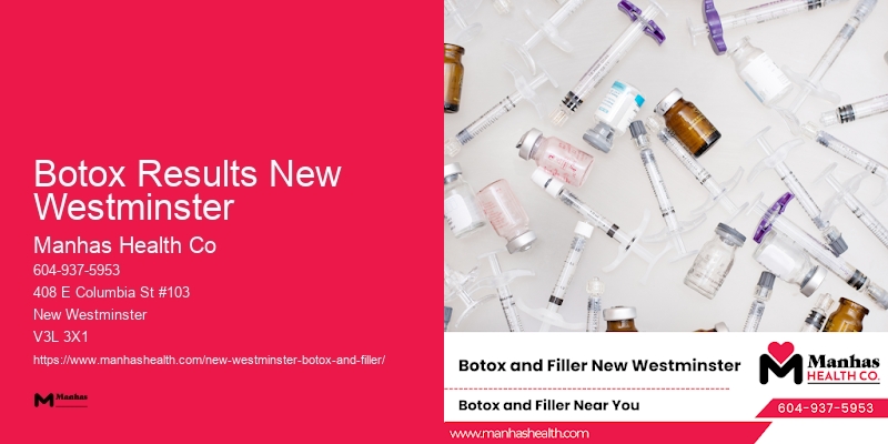 Botox treatment before and after Botox Results New Westminster