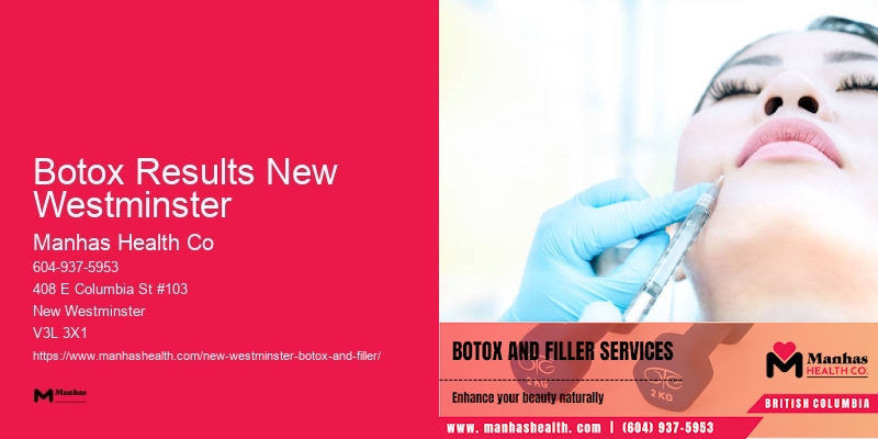 Botox Results New Westminster Botox packages