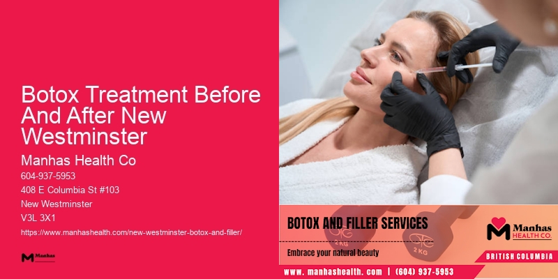 Botox treatment availability Botox Treatment Before And After New Westminster