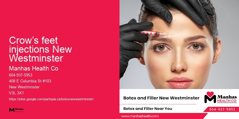 Crow’s feet injections New Westminster