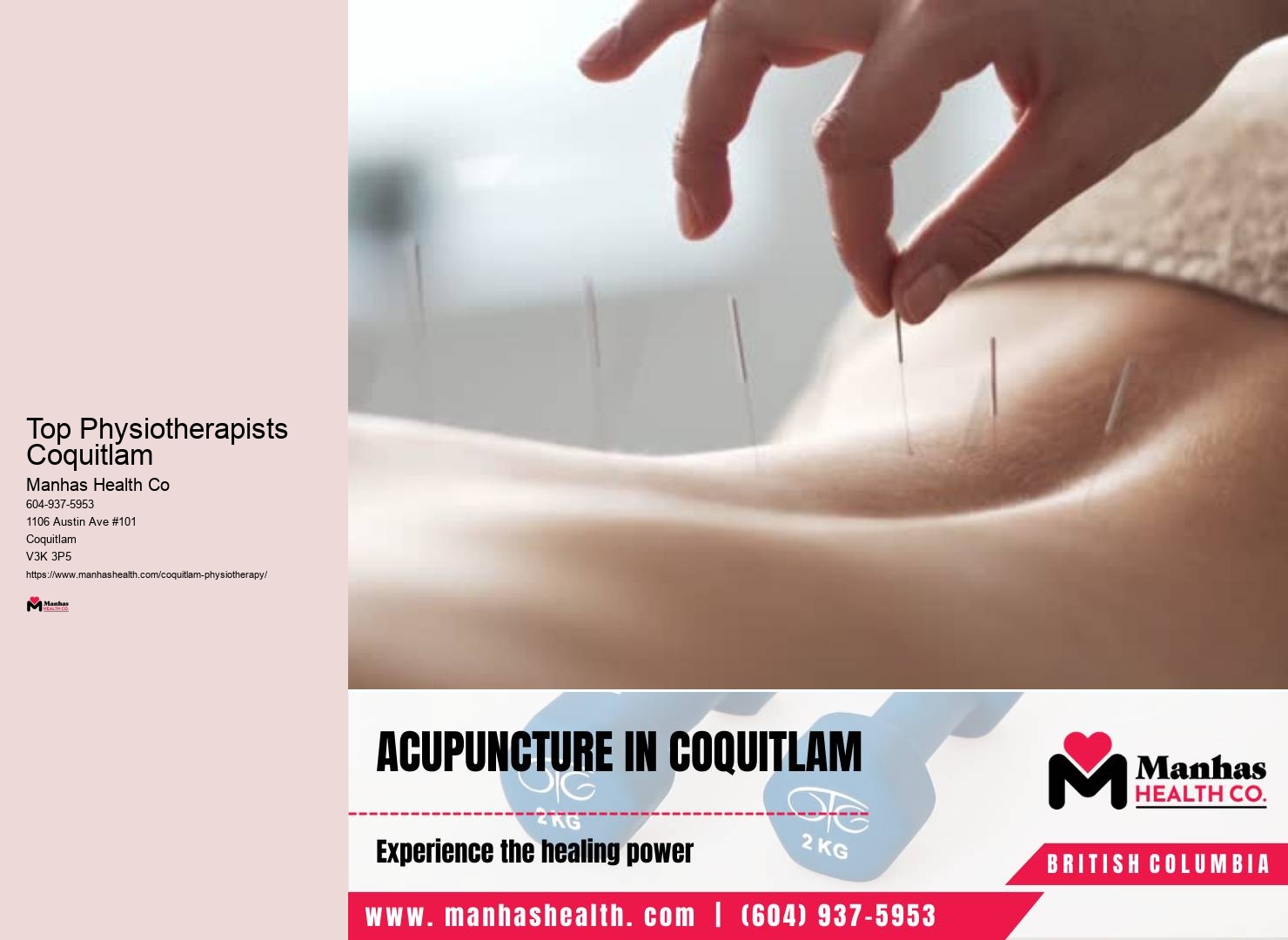 Physiotherapy clinic near me Top Physiotherapists Coquitlam