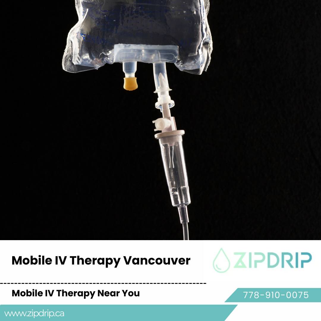 IV Drip Therapy At Home Mobile vitamin drips Vancouver