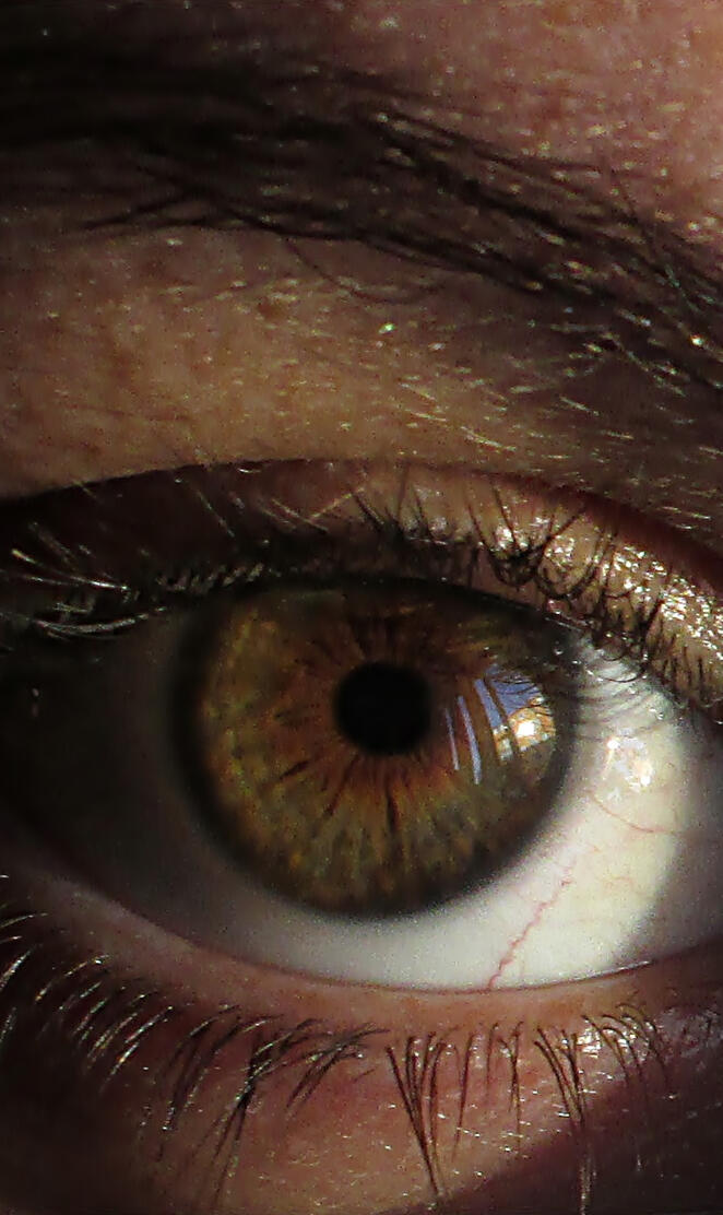 my eye