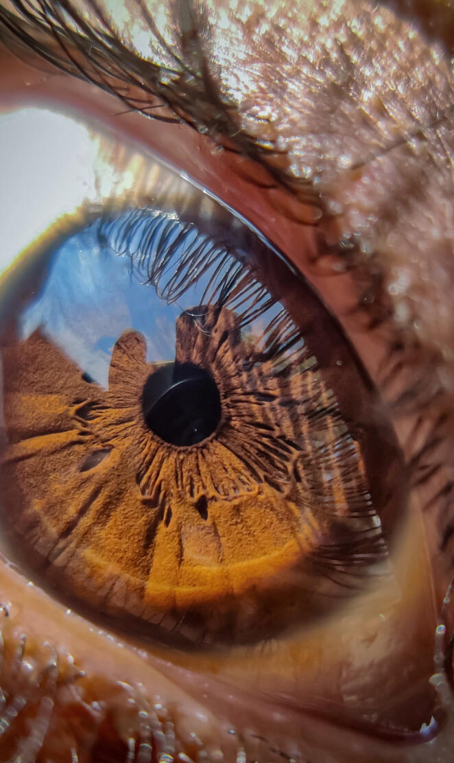 Eye macro